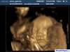 Ecograf&iacute;a 4D de Sammy con 32 semanas de gestaci&oacute;n 01
